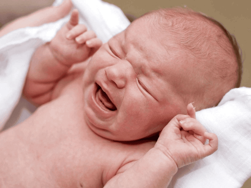 Dị ứng tã ở trẻ có rất nhiều nguyên nhân